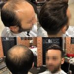 calota-par-natural-barbati-small-0