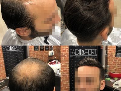 calota-par-natural-barbati